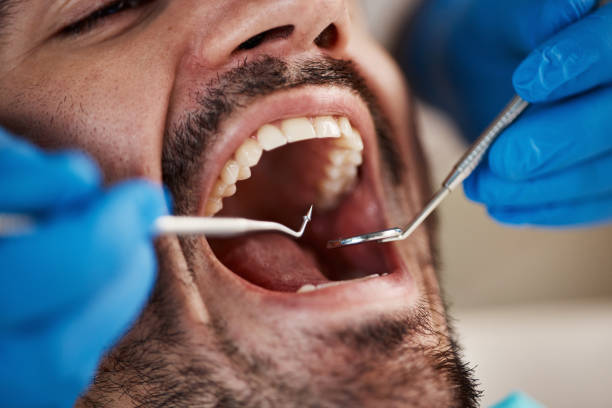 Professional Emergency Dental Service in KS